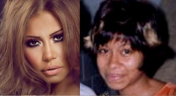 Arab Celebrities Before After